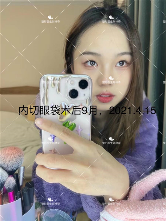 刘林奇厉害吗