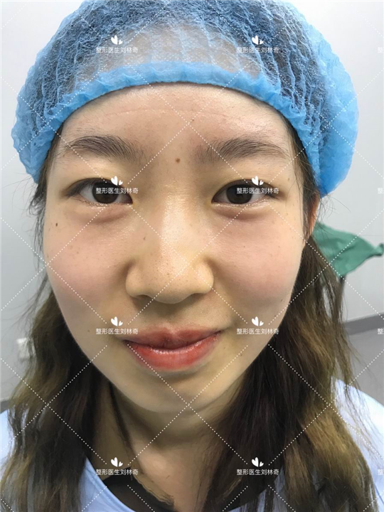 刘林奇整形