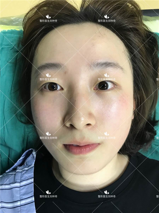 刘林奇医生