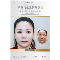 长沙唤醒再生术