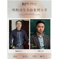 唤醒再生术全脸案例