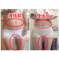 长沙懒人健康瘦案例