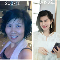 唤醒再生术全脸案例