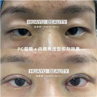 长沙pc无痕美眼案例