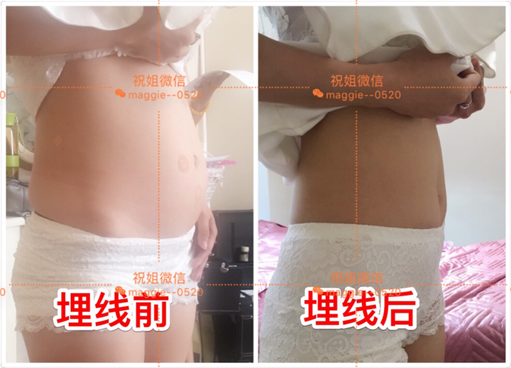 长沙懒人健康瘦案例