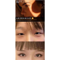 长沙pc无痕美眼案例
