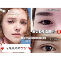 长沙pc无痕美眼案例