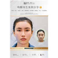 长沙唤醒再生术