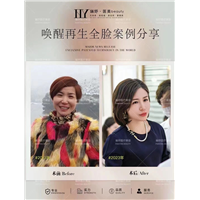 唤醒再生术全脸案例