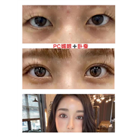 长沙pc无痕美眼案例