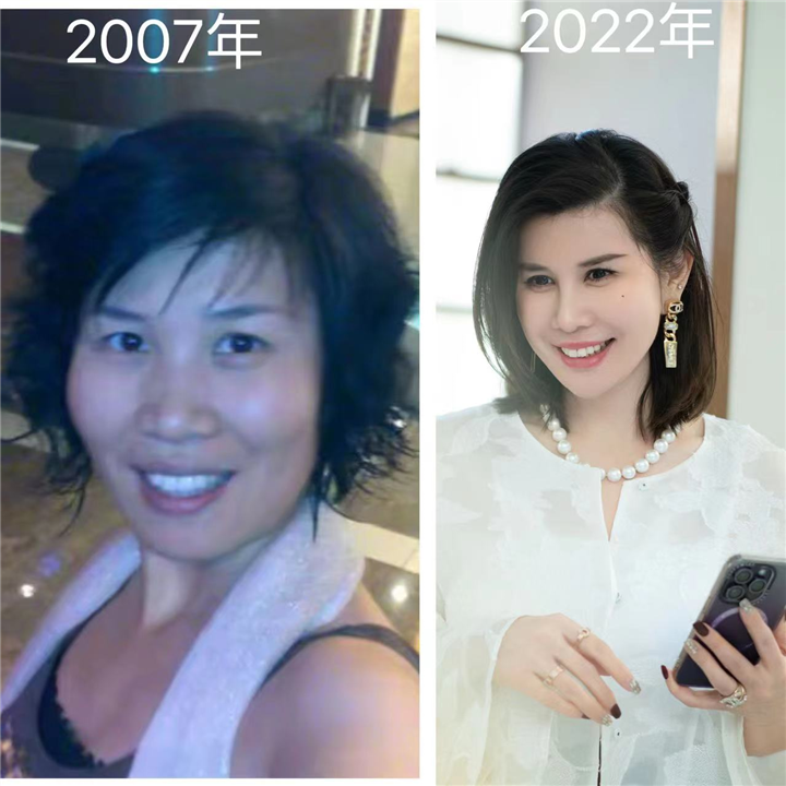 唤醒再生术全脸案例