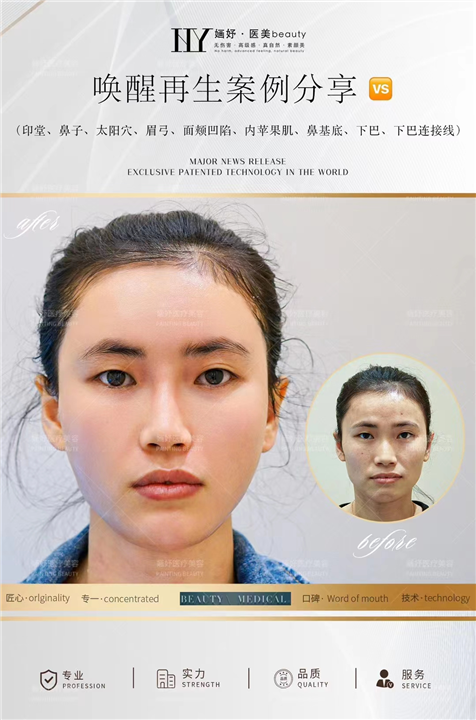 长沙唤醒再生术