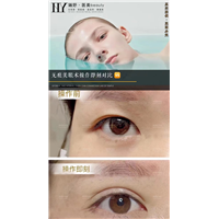 长沙pc无痕美眼案例