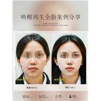 长沙唤醒再生术