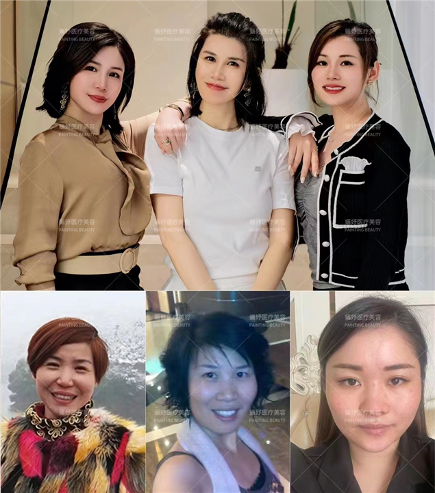 唤醒再生术全脸案例