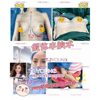 上海眼综合整形医院｜上海网红整形哪家好