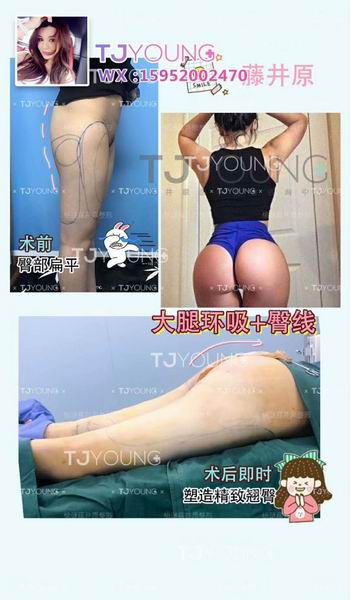 上海网红整形修复｜上海人气网红整形