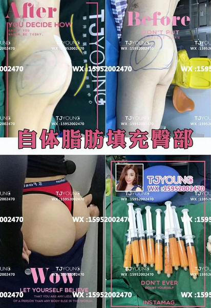 上海网红整形修复｜上海人气网红整形