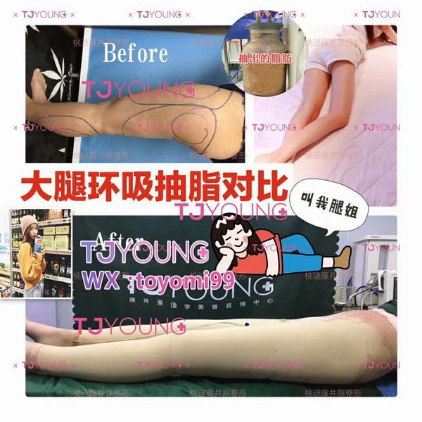 上海网红整形修复｜上海人气网红整形