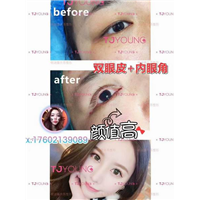 上海网红整形｜上海网红整形医院