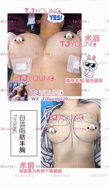 上海网红整形哪家好｜上海哪家网红整形专业