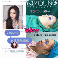 上海人气网红整形｜上海人气网红整形医院
