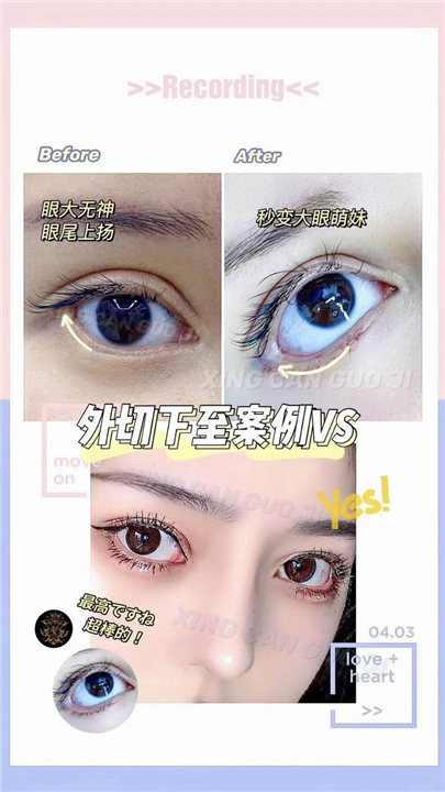 上海眼综合整形医生