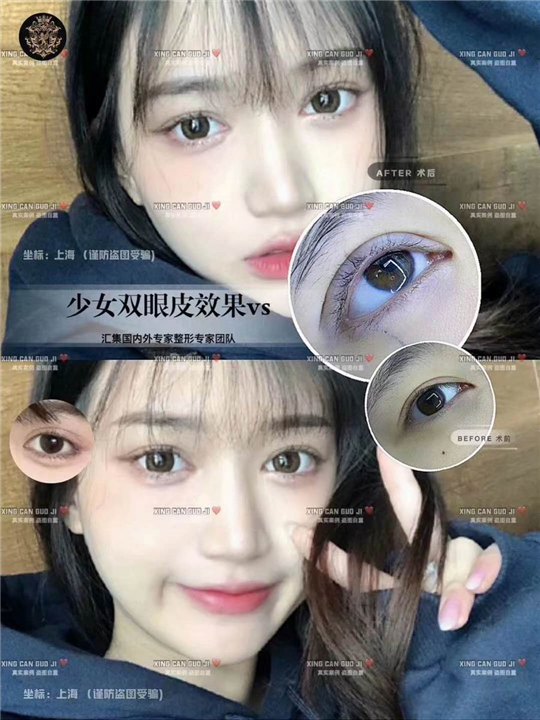 上海眼综合整形医生