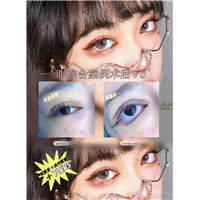 上海眼综合整形医生