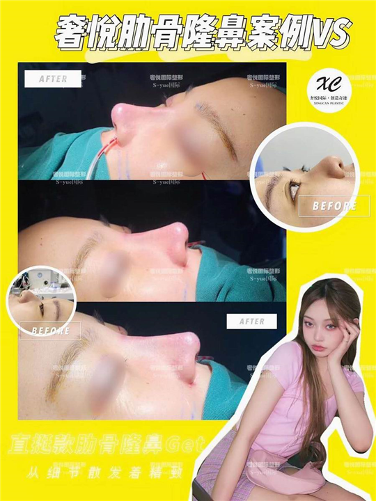上海鼻整形修复医生
