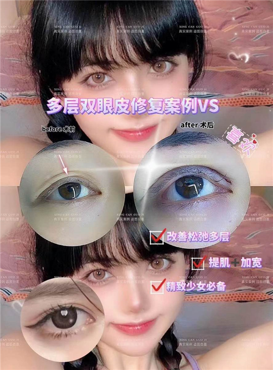 上海眼综合整形医生