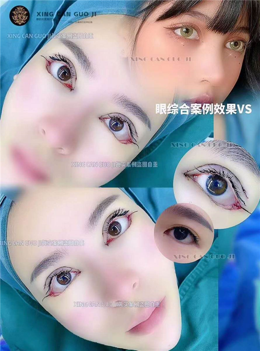 上海眼综合整形医生