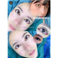 上海眼综合整形医生
