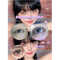 上海眼综合整形医生