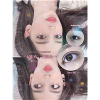 上海眼综合整形医生