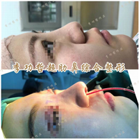 李功哲