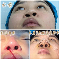 李功哲整形医生