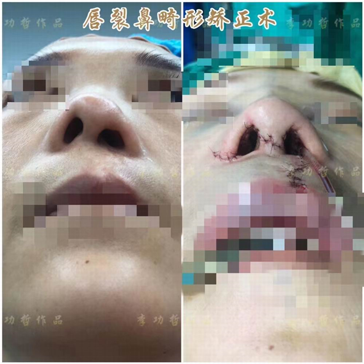 李功哲