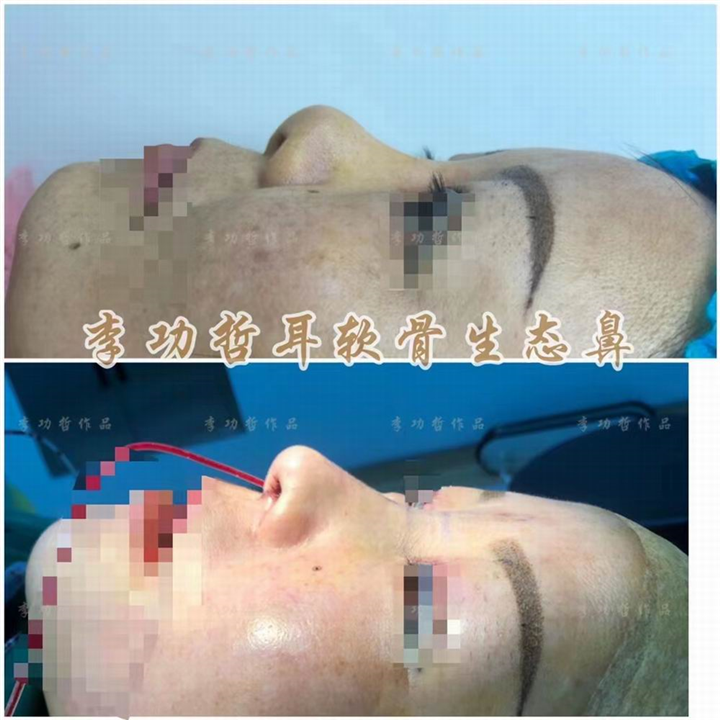 李功哲
