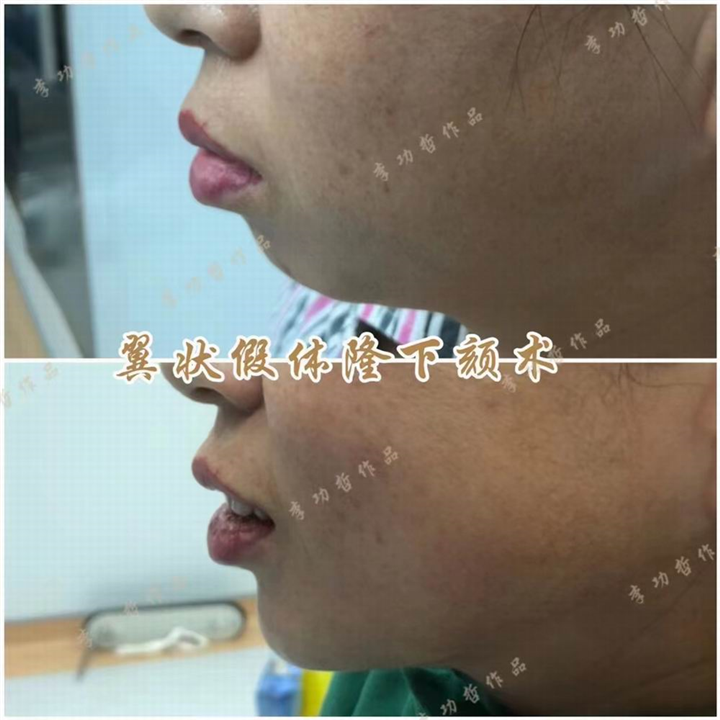 李功哲医生
