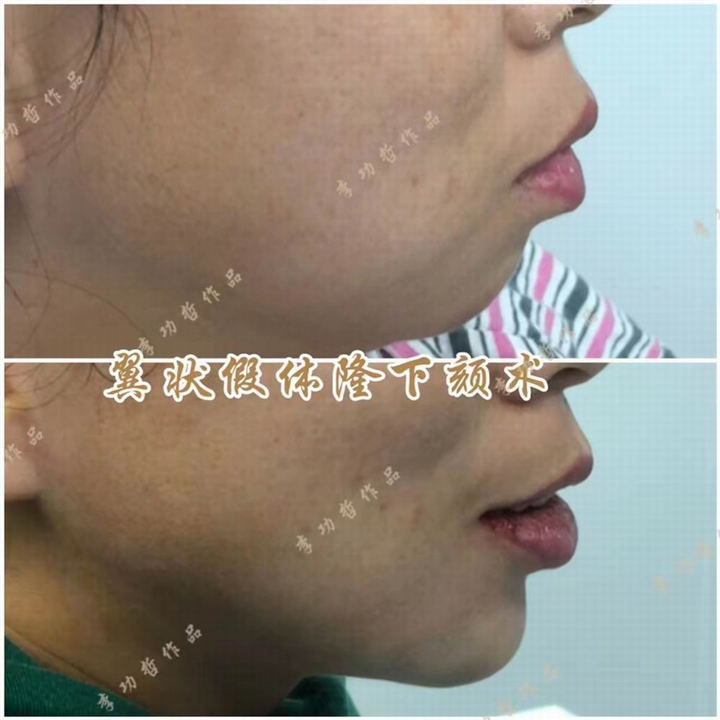 李功哲医生