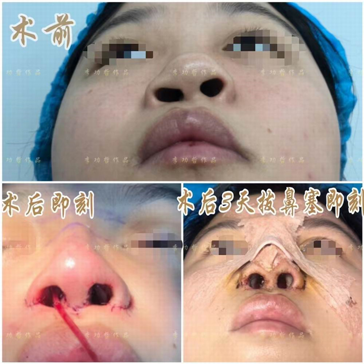 李功哲整形医生