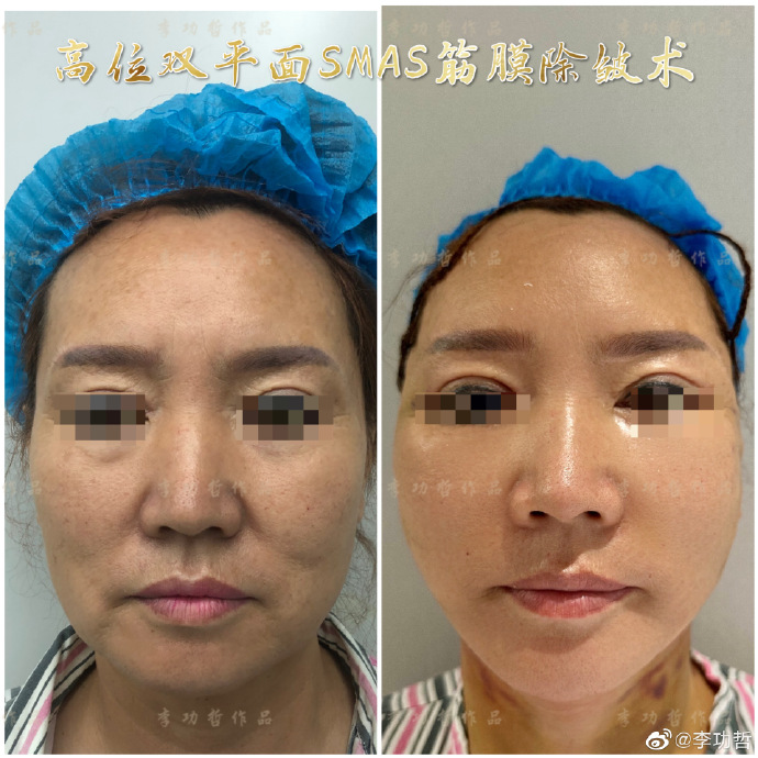 李功哲