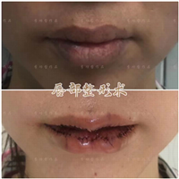 李功哲