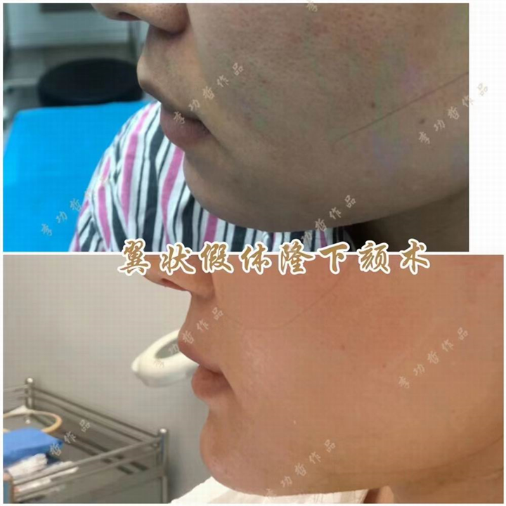 李功哲医生