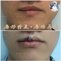 李功哲医生