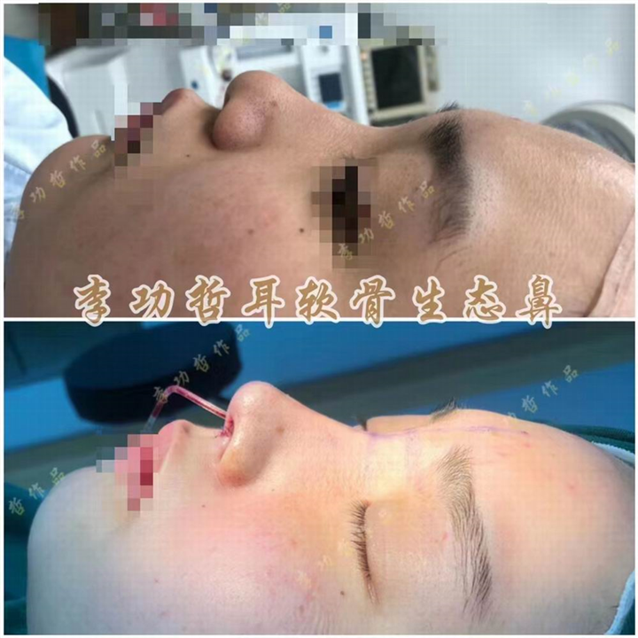 李功哲整形医生