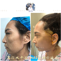 李功哲