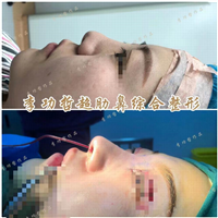 李功哲