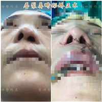李功哲